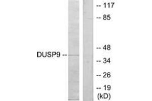 Western blot analysis of extracts from HeLa cells, using DUSP9 Antibody. (DUSP9 anticorps  (AA 151-200))