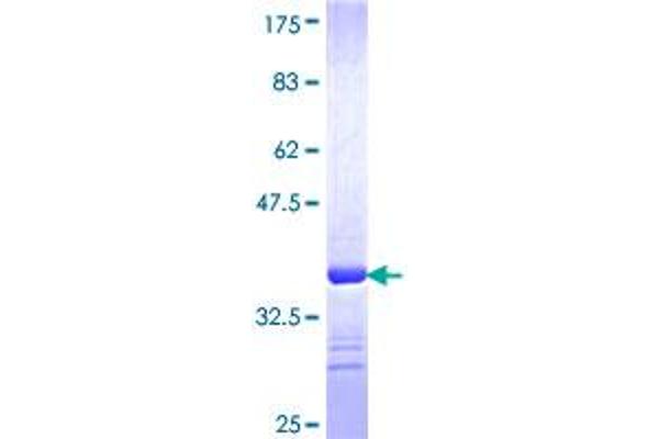 SFRS6 Protein (AA 1-75) (GST tag)