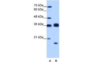 WB Suggested Anti-HNRPH3 Antibody Titration:  1. (HNRNPH3 anticorps  (N-Term))