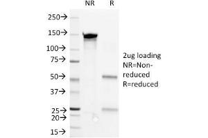 SDS-PAGE Analysis Purified CD36 Mouse Monoclonal Antibody (1E8). (CD36 anticorps)