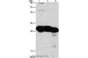 Western blot analysis of Mouse liver and kidney tissue, human fetal liver tissue, using KHK Polyclonal Antibody at dilution of 1:1350 (Ketohexokinase anticorps)