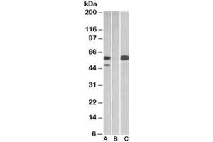 Western blot testing of HEK293 lysate overexpressing human TRIM21 with MYC tag with TRIM21 antibody [1ug/ml] in Lane A and probed with anti-MYC tag [1/1000] in lane C. (TRIM21 anticorps)