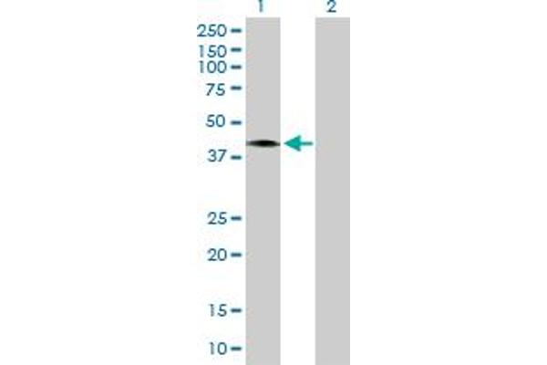 CCNDBP1 anticorps  (AA 1-360)