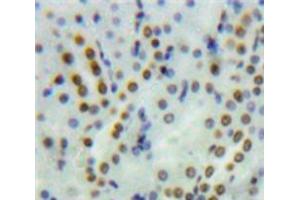 IHC-P analysis of Kidney tissue, with DAB staining. (PYGO1 anticorps  (AA 201-419))