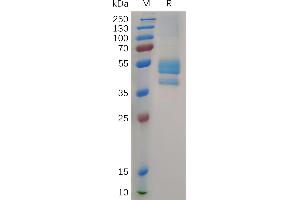 Cynomolgus Protein, hFc Tag on SDS-PAGE under reducing condition. (CCL24 Protein (AA 27-119) (Fc Tag))