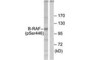 Western blot analysis of extracts from 293 cells treated with EGF 200ng/ml 30', using B-RAF (Phospho-Ser446) Antibody. (SNRPE anticorps  (pSer446))