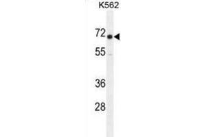 Western Blotting (WB) image for anti-Insulin-Like Growth Factor 2 mRNA Binding Protein 1 (IGF2BP1) antibody (ABIN2995660) (IGF2BP1 anticorps)