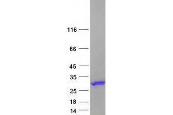 ZBTB8OS Protein (Myc-DYKDDDDK Tag)