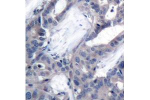 Immunohistochemistry (IHC) image for anti-Mitogen-Activated Protein Kinase Kinase 2 (MAP2K2) (pThr394) antibody (ABIN1870344) (MEK2 anticorps  (pThr394))