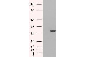 Western Blotting (WB) image for anti-GRB2-Related Adaptor Protein 2 (GRAP2) antibody (ABIN5901198) (GRAP2 anticorps)