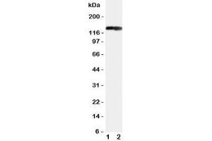 Western blot testing of COL2A1 antibody and Lane 1:  rat heart (COL2A1 anticorps  (C-Term))