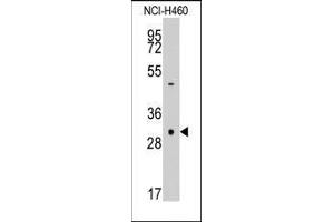 Western blot analysis of anti-CASP3 Pab in NCI-H460 cell line lysates (35ug/lane). (Caspase 3 anticorps  (Middle Region))