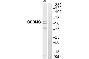 Western blot analysis of extracts from 293 cell, using GSDMC antibody. (MLZE anticorps  (Internal Region))