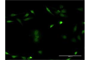 Immunofluorescence of monoclonal antibody to CSNK1E on HeLa cell. (CK1 epsilon anticorps  (AA 2-100))