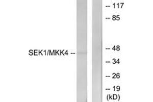 Western blot analysis of extracts from NIH-3T3 cells, using SEK1/MKK4 (Ab-80) Antibody. (MAP2K4 anticorps  (AA 46-95))