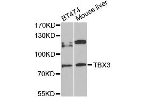 Western blot analysis of extracts of various cell lines, using TBX3 antibody (ABIN5972282) at 1/1000 dilution. (TBX3 anticorps)