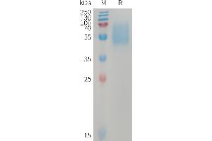 Human AC Protein, hFc Tag on SDS-PAGE under reducing condition. (ACVR1C/ALK7 Protein (AA 22-113) (Fc Tag))