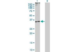 Western Blot analysis of CDK5 expression in transfected 293T cell line by CDK5 MaxPab polyclonal antibody. (CDK5 anticorps  (AA 1-292))
