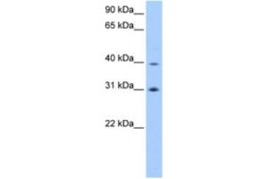 Western Blotting (WB) image for anti-Eukaryotic Translation Initiation Factor 3 Subunit H (EIF3H) antibody (ABIN2463339) (EIF3H anticorps)