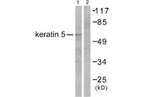 Western blot analysis of extracts from HepG2 cells, using Keratin 5 antibody (ABIN5976441). (Cytokeratin 5 anticorps  (C-Term))
