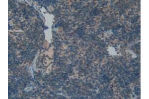 IHC-P analysis of Rat Spleen Tissue, with DAB staining. (FGFRL1 anticorps  (AA 164-368))