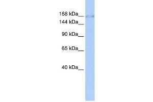 ZNF608 antibody used at 0. (ZNF608 anticorps  (Middle Region))