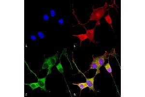 Immunocytochemistry/Immunofluorescence analysis using Mouse Anti-Ataxin 1 Monoclonal Antibody, Clone S76-8 (ABIN1741212). (Ataxin 1 anticorps  (AA 164-197) (PerCP))