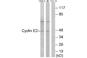 Immunohistochemistry analysis of paraffin-embedded human thyroid gland tissue using Cyclin(Ab-392) antibody. (Cyclin E2 anticorps)