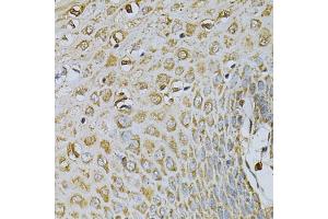 Immunohistochemistry of paraffin-embedded human esophagus using CDA Antibody (ABIN6291347) at dilution of 1:100 (40x lens). (CDA anticorps)