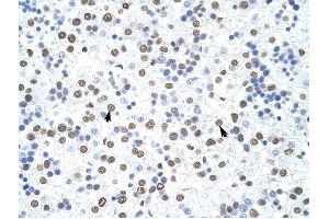 HNRPD antibody was used for immunohistochemistry at a concentration of 4-8 ug/ml to stain Hepatocytes (arrows) in Human Liver. (HNRNPD/AUF1 anticorps)