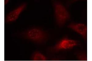 Image no. 2 for anti-Amyloid beta (A4) Precursor Protein (APP) (AA 666-670) antibody (ABIN197432)