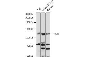Western blot analysis of extracts of various cell lines, using PTK2B antibody (ABIN7269745) at 1:1000 dilution. (PTK2B anticorps  (AA 1-100))