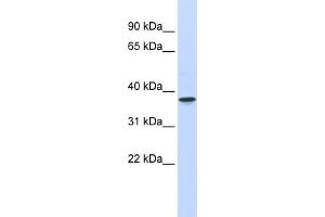 WB Suggested Anti-THOC6 Antibody Titration:  0. (THOC6 anticorps  (Middle Region))