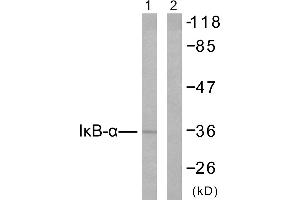 Western blot analysis of extracts from 293 cells untreated or treated with TNF-α (20ng/ml, 30min), using IκB-α (Ab-42) antibody (#B7116). (NFKBIA anticorps  (Tyr42))