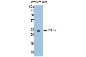 Western Blotting (WB) image for anti-serpin Peptidase Inhibitor, Clade A (Alpha-1 Antiproteinase, Antitrypsin), Member 6 (SERPINA6) (AA 25-195) antibody (ABIN1174369) (SERPINA6 anticorps  (AA 25-195))