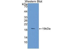 Western Blotting (WB) image for anti-alpha-2-Glycoprotein 1, Zinc-Binding (AZGP1) (AA 148-298) antibody (ABIN2117195) (AZGP1 anticorps  (AA 148-298))