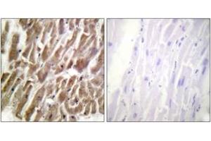 Immunohistochemistry analysis of paraffin-embedded human heart tissue, using TNNI3 (Ab-43) Antibody. (TNNI3 anticorps  (AA 11-60))