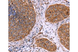 Immunohistochemistry (IHC) image for anti-Clusterin Associated Protein 1 (CLUAP1) antibody (ABIN2423174) (CLUAP1 anticorps)