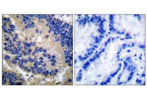 Immunohistochemistry (IHC) image for anti-Caspase 3 (CASP3) (Cleaved-Asp175) antibody (ABIN1853450) (Caspase 3 anticorps  (Cleaved-Asp175))