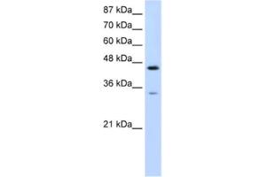 Western Blotting (WB) image for anti-Splicing Factor 3b, Subunit 4, 49kDa (SF3B4) antibody (ABIN2462194) (SF3B4 anticorps)