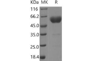 Western Blotting (WB) image for Podoplanin (PDPN) protein (Fc Tag,ECD) (ABIN7321058) (Podoplanin Protein (PDPN) (Fc Tag,ECD))