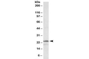 Western blot testing of K562 lysate with PSMB3 antibody at 1ug/ml. (PSMB3 anticorps)