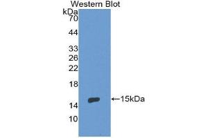 Western Blotting (WB) image for anti-Endoglin (ENG) (AA 336-450) antibody (ABIN1858718) (Endoglin anticorps  (AA 336-450))