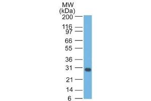 Image no. 1 for anti-BCL2-Like 1 (BCL2L1) (AA 3-14) antibody (ABIN6175399) (BCL2L1 anticorps  (AA 3-14))