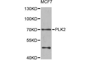 Western blot analysis of extracts of MCF7 cells, using PLK2 antibody. (PLK2 anticorps)