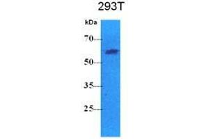 The cell lysates (40 ug) were resolved by SDS-PAGE, transferred to PVDF membrane and probed with anti-human PKLR antibody (1:500). (PKLR anticorps  (AA 47-574))