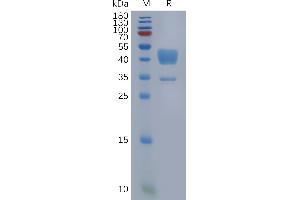 Human C5AR1 Protein, hFc Tag on SDS-PAGE under reducing condition. (C5AR1 Protein (AA 1-37) (Fc Tag))