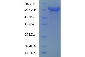 SDS-PAGE (SDS) image for Glucose-6-Phosphate Dehydrogenase (G6PD) (AA 1-486), (partial) protein (GST tag) (ABIN5713166) (Glucose-6-Phosphate Dehydrogenase Protein (G6PD) (AA 1-486, partial) (GST tag))