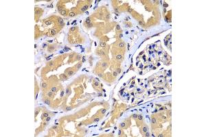 Immunohistochemistry of paraffin-embedded human kidney using WIPI2 antibody (ABIN5975599) at dilution of 1/100 (40x lens). (WIPI2 anticorps)