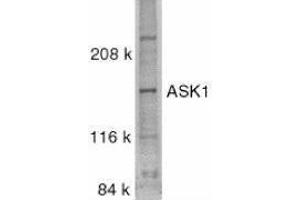 Western Blotting (WB) image for anti-Mitogen-Activated Protein Kinase Kinase Kinase 5 (MAP3K5) (C-Term) antibody (ABIN2477505) (ASK1 anticorps  (C-Term))